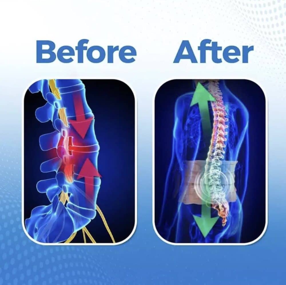 Results of using BackReliever